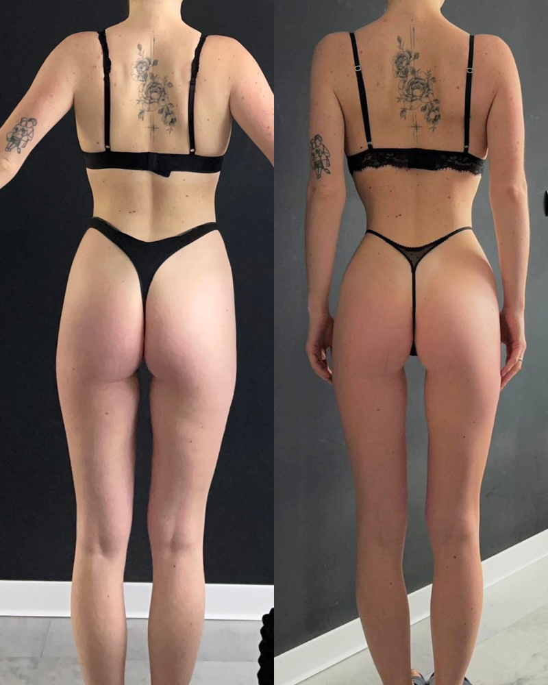 Ania • -9 kg w 4 miesiące